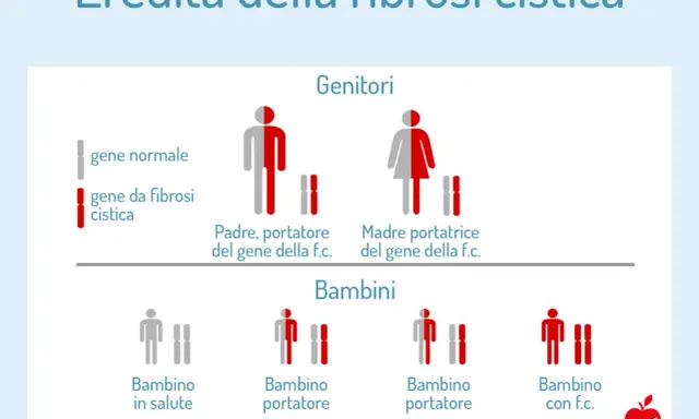 Schema sull'eredità della fibrosi cistica. Mostra genitori portatori sani e i possibili esiti per i bambini, inclusa la fibrosi cistica atipica.
