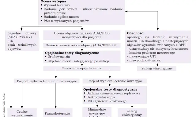 Schemat diagnostyczny BPH: USG gruczołu krokowego jako jedna z opcji po ocenie objawów i wyborze leczenia inwazyjnego.