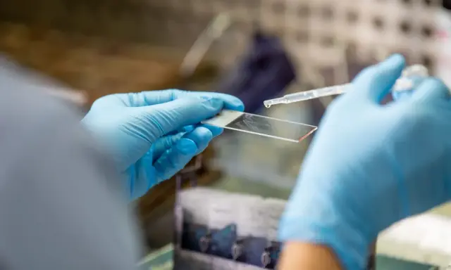 Ręce w niebieskich rękawiczkach trzymają szkiełko mikroskopowe, na które pipetą dodawana jest kropla płynu.