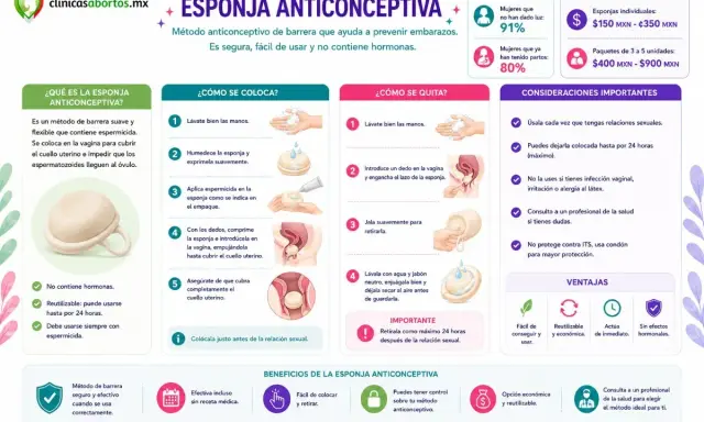 La esponja anticonceptiva es un método de barrera suave y flexible que se coloca en la vagina para prevenir embarazos.