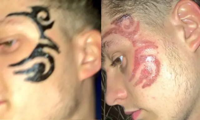 Henna do brwi jako tatuaż? Ryzykujesz zdrowie i blizny!