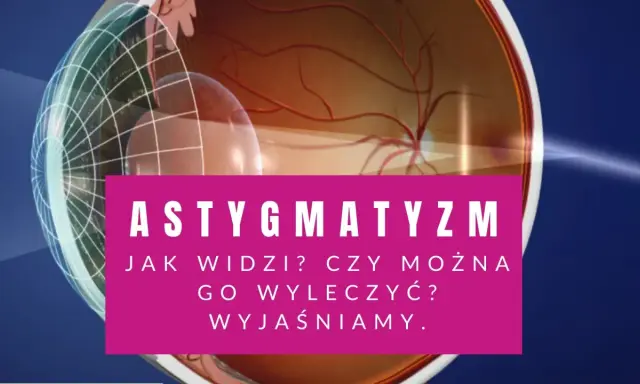 Astygmatyzm: jak widzi oko? Czy można go wyleczyć? Wyjaśniamy. Wizyta u okulisty lub optometrysty pomoże.