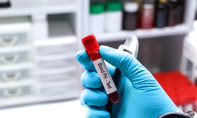Ręka w niebieskiej rękawiczce trzyma probówkę z krwią do badania pH. Gazometria jest kluczowa w diagnostyce niewydolności nerek.