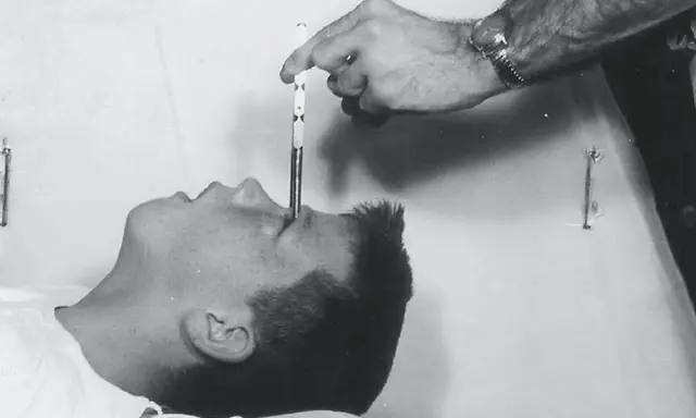 En hand för in en lobotomikniv i en patients öga. En mörk period i psykiatrins historia, även i Sverige.