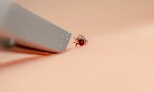Kleszcz? Usuń go bezpiecznie! Instrukcja krok po kroku i mity