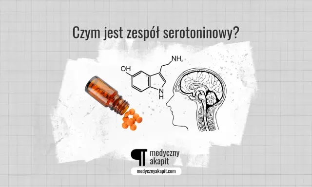 Pigułki wypadające z buteleczki, wzór chemiczny serotoniny i przekrój mózgu – wszystko to ilustruje, czym jest zespół serotoninowy.