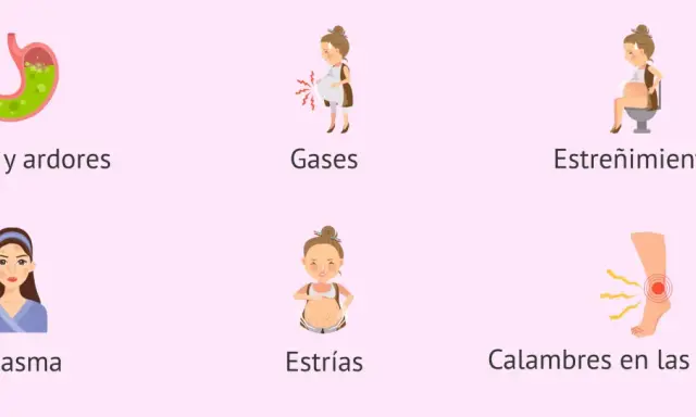 Ilustraciones de síntomas comunes del embarazo: reflujo, gases, estreñimiento, cloasma, estrías y calambres en las piernas. Semana 25.