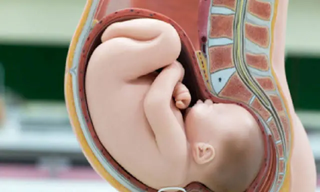 Model anatomiczny przedstawia dziecko w łonie matki w prawidłowym **położeniu główkowym**.