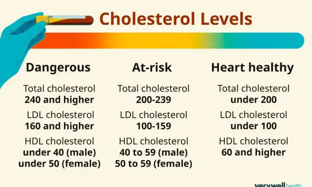 Poziomy cholesterolu: wysoki cholesterol jest niebezpieczny. Tabela pokazuje wartości dla cholesterolu całkowitego, LDL i HDL.