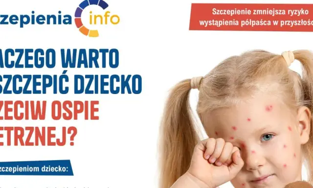 Dziewczynka z ospą wietrzną. Kampania informacyjna o szczepionce na ospę, podkreślająca jej znaczenie dla zdrowia dziecka.