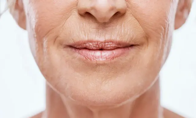 Gros plan sur le visage d'une femme, montrant les rides et ridules qui témoignent du vieillissement de la peau.