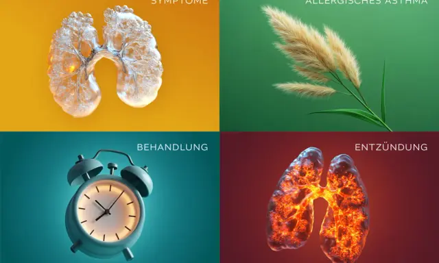 Vier Bilder zeigen: Lunge mit Symptomen, Gräser (allergisches Asthma), Wecker (Behandlung) und entzündete Lunge. So ist Asthma.