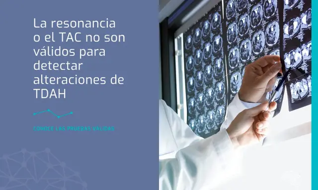 Médico revisa TACs cerebrales. La resonancia o TAC no detectan TDAH. Descubre qué puede estudiar un adolescente con TDAH.