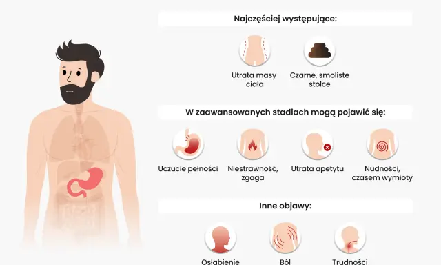 Objawy raka żołądka: utrata masy ciała, czarne stolce, uczucie pełności, zgaga, utrata apetytu, nudności, osłabienie, ból pleców, trudności w połykaniu.