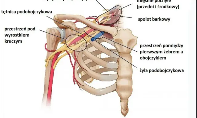Anatomia górnego otworu klatki piersiowej: tętnica i żyła podobojczykowa, mięśnie pochyłe, splot barkowy.