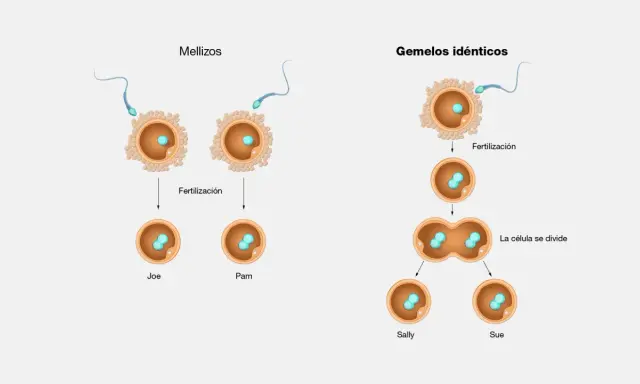 Ilustración de la fertilización de óvulos por espermatozoides, mostrando mellizos y gemelos idénticos.