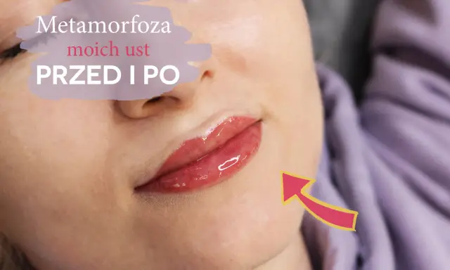 Metamorfoza moich ust przed i po. Czy makijaż permanentny ust boli? Zobacz efekt!