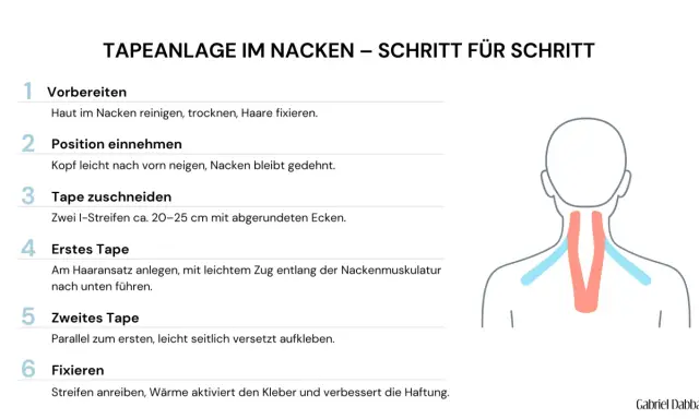 Anleitung zur Tapeanlage im Nacken. Hilft bei nackenschmerzen schnell. Schritt-für-Schritt-Anleitung mit Illustration.