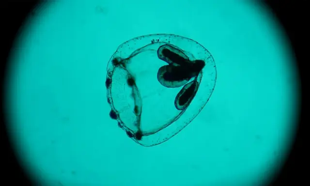 Medusa Turritopsis nutricula, immortale, vista al microscopio. Struttura trasparente con organi scuri interni.