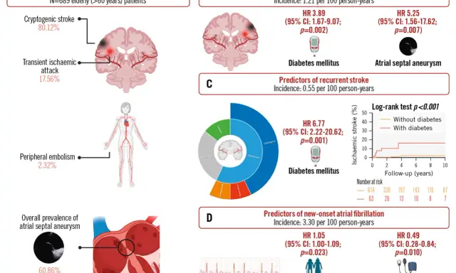 PFO closure indications: 80% kryptogenny udar, 17% TIA. Obraz przedstawia objawy neurologiczne i czynniki ryzyka udaru.