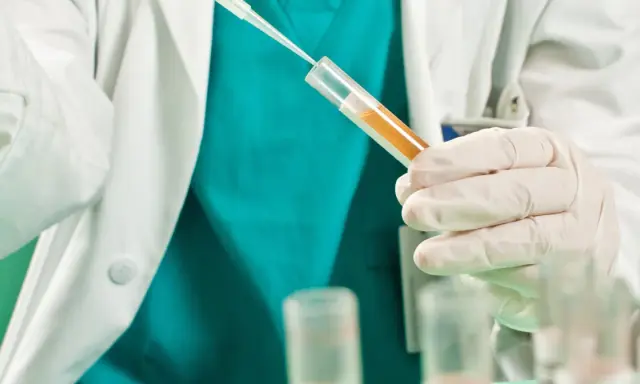 Badacz w białym fartuchu i rękawiczkach pobiera próbkę płynu do probówki. Badanie może pomóc ustalić, jak zahamować krwiomocz.