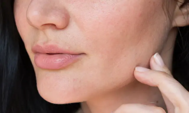 Dita che accarezzano il viso, mostrando come idratare la pelle del viso molto secca per un aspetto radioso e morbido.