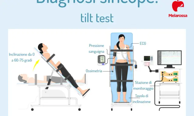 Test tilt per la diagnosi di sincope. Monitoraggio ECG, pressione e ossimetria. Simula la sensazione di svenire ma non svengo, ansia.
