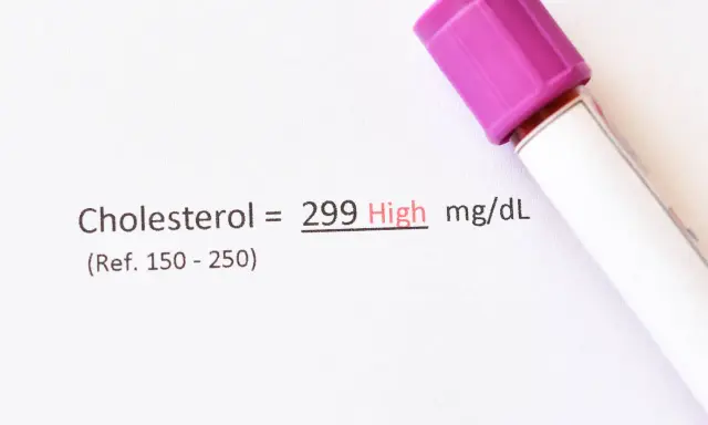 Wynik cholesterolu 299 mg/dL, co oznacza wysoki poziom. Wartość referencyjna to 150-250.