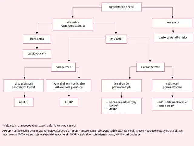 Schemat diagnostyczny torbieli nerek. Wskazuje na torbiel korową nerki, jej wielkość i objawy, prowadząc do rozpoznania.