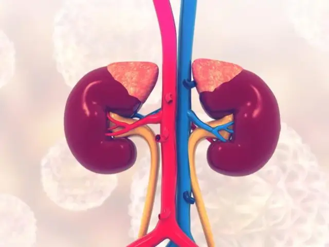 Anatomical illustration of healthy kidneys with blood vessels. Wodonercze to poważny stan, który może dotknąć te narządy.