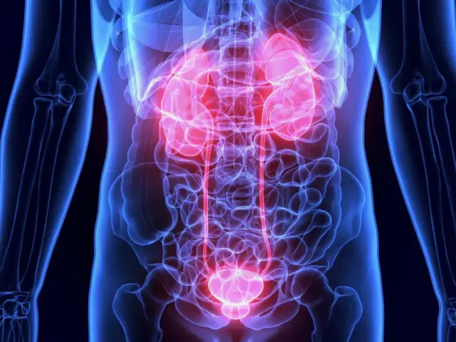 Anatomia układu moczowego z podświetlonymi na czerwono nerkami i pęcherzem. Dowiedz się, co jest dobre na nerki.