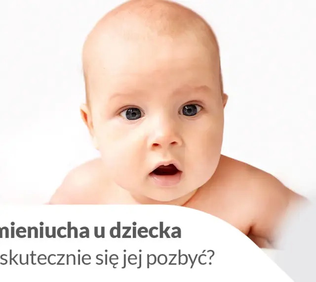 Urocze niemowlę z zaciekawioną miną. Tekst informuje o ciemieniuchy u dziecka i sposobach jej usuwania.