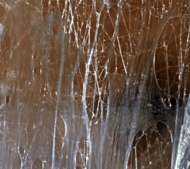 Nahaufnahme von verklebten Faszien, die an ein Spinnennetz erinnern. Medikamente gegen verklebte Faszien können hier helfen, die Elastizität wiederherzustellen.