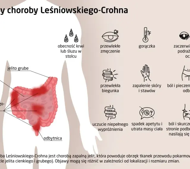 Objawy choroby Leśniowskiego-Crohna: krew w stolcu, zmęczenie, gorączka, problemy z oczami, biegunka, bóle brzucha, zapalenie skóry i stawów.
