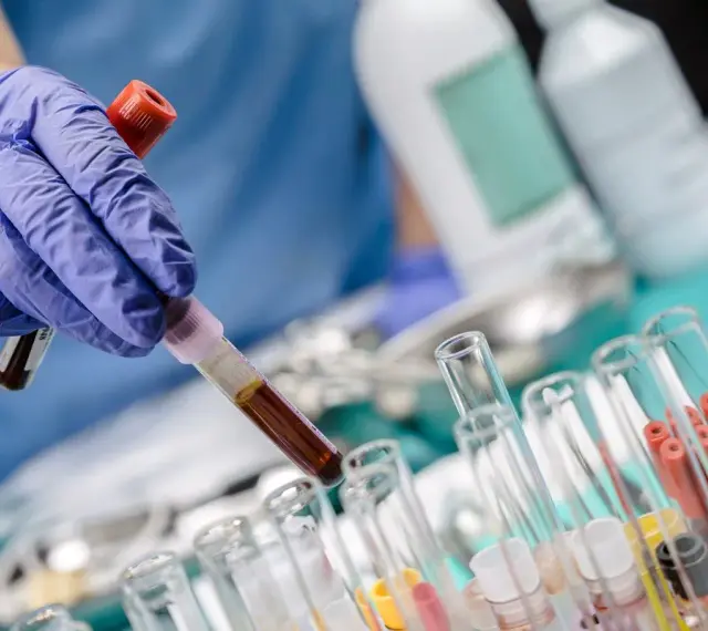 Ręka w niebieskiej rękawiczce trzyma probówkę z ciemnym płynem, prawdopodobnie badanie bilirubina całkowita. W tle inne probówki i butelki laboratoryjne.