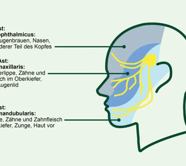 Schema des Trigeminusnervs mit seinen drei Ästen, die verschiedene Gesichtsbereiche versorgen. Eine sanfte Massage kann hier Linderung verschaffen.