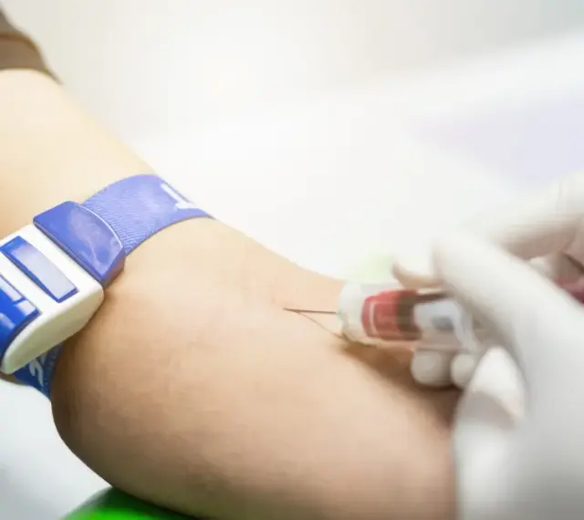 Pobieranie krwi do badań, w tym APTT. Ręka z opaską uciskową, igła i probówka.