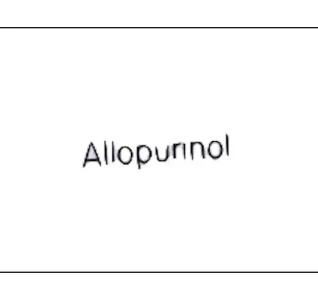Napis "Allopurinol" na białym tle. Lek Milurit 300 pomaga w leczeniu dny moczanowej.