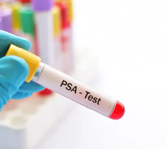 Ręka w niebieskiej rękawiczce trzyma probówkę z napisem "PSA - Test". W tle widać inne probówki.