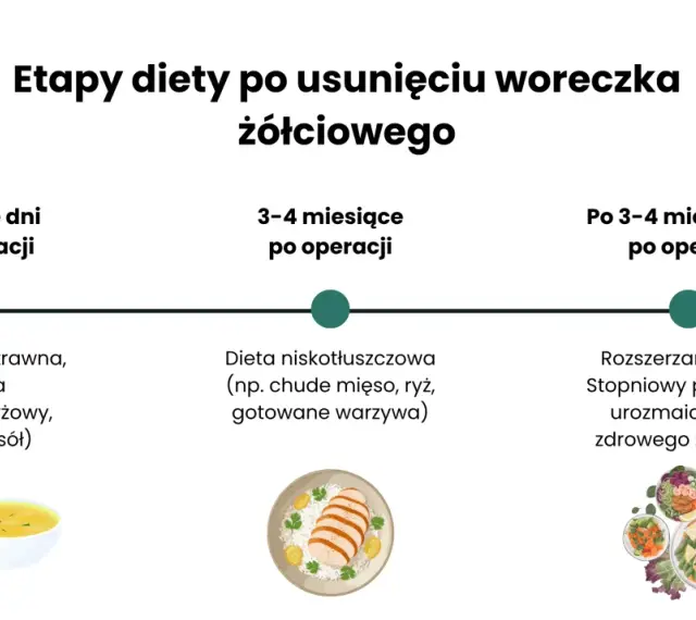 Etapy diety po usunięciu woreczka żółciowego: lekkostrawna, niskotłuszczowa, a potem stopniowy powrót do zdrowego żywienia.