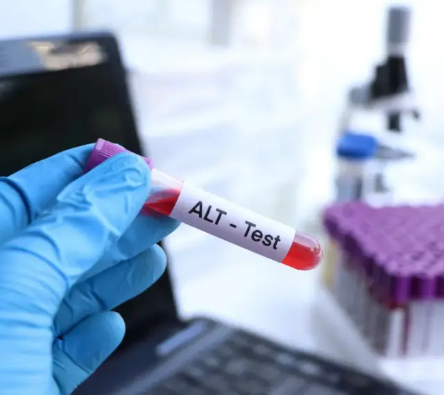 Ręka w niebieskiej rękawiczce trzyma probówkę z krwią oznaczoną "ALT - Test". W tle mikroskop i stojak z próbkami. To badanie ALT.