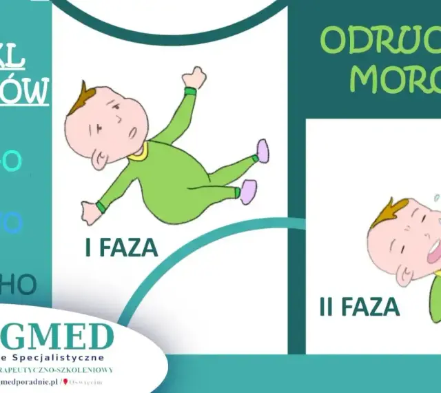 Ilustracja przedstawia dwie fazy odruchu Moro u niemowląt: pierwszą, gdzie dziecko jest wyciągnięte, i drugą, gdzie płacze.