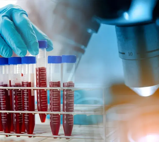 Rękawiczka laboratoryjna trzyma probówkę z krwią na tle mikroskopu.