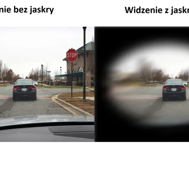 Porównanie widzenia: po lewej normalne, po prawej z jaskrą, gdzie centralne pole widzenia jest zamazane.