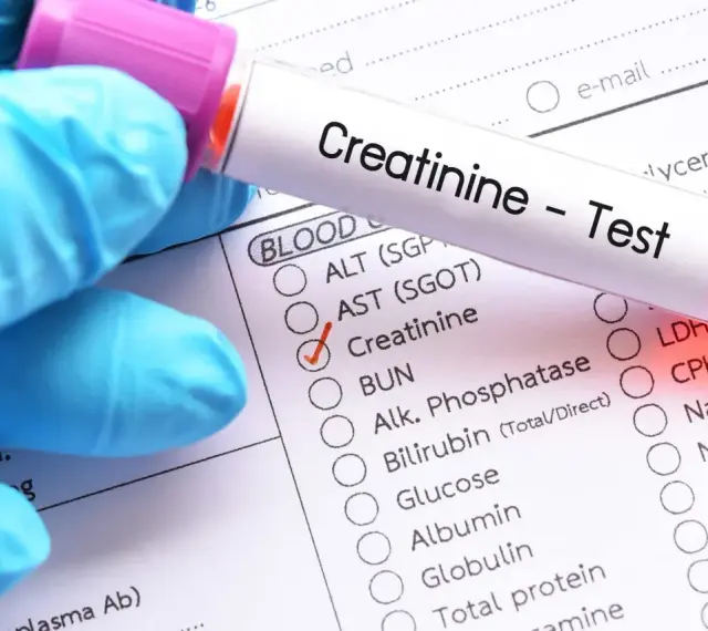 Ręka w niebieskiej rękawiczce trzyma probówkę z napisem "Creatinine - Test". Zaznaczono opcję "Creatinine" na formularzu badań.