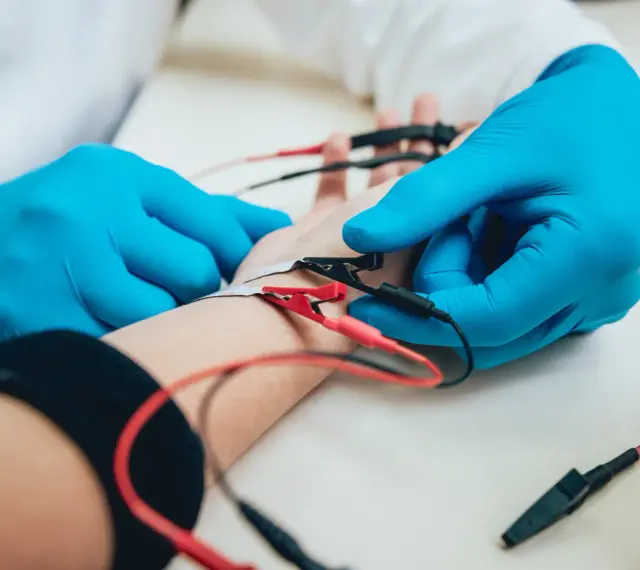 Lekarz w niebieskich rękawiczkach podłącza elektrody do ręki pacjenta. To badanie EMG, które pozwala ocenić funkcje nerwów i mięśni.