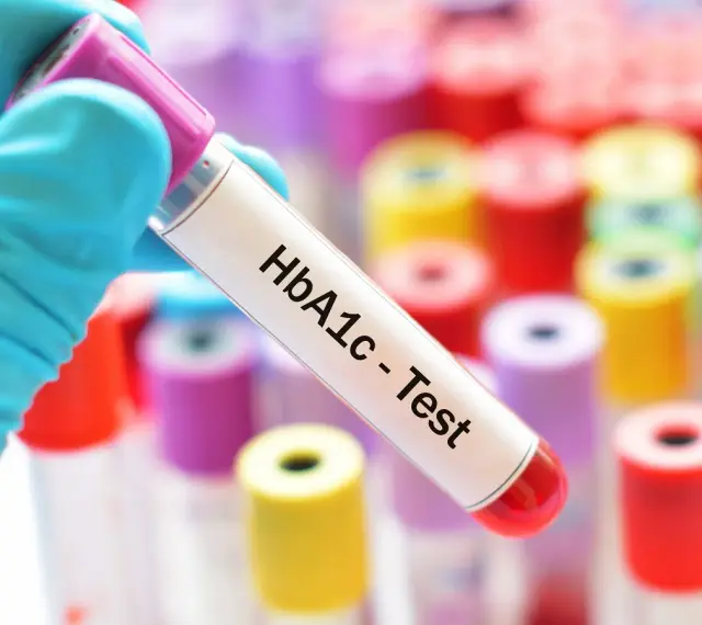 Ręka w niebieskiej rękawiczce trzyma probówkę z napisem "HbA1c - Test". W tle kolorowe probówki. Sprawdź, jaka jest hemoglobina glikowana cena.
