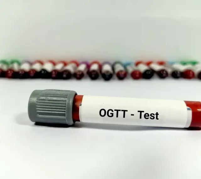 Probówka z oznaczeniem "OGTT - Test" na tle rzędu innych próbek. Wyniki tego testu pozwalają ocenić krzywą cukrową.