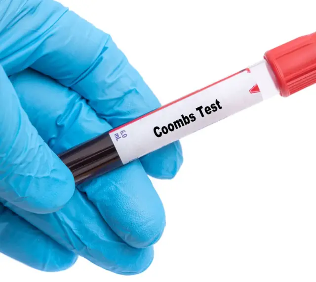 Rękawiczka medyczna trzyma probówkę z krwią do badania. Na etykiecie widnieje napis "Coombs Test", wskazujący na wykonanie odczynu Coombsa.
