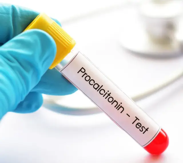 Ręka w niebieskiej rękawiczce trzyma probówkę z napisem "Procalcitonin - Test". To ważny pct.